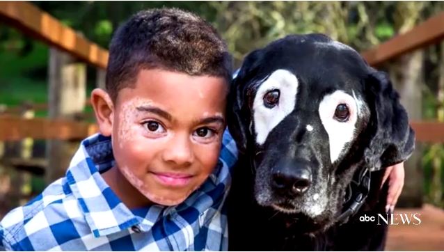 Dog Famous for Having Vitiligo Has Helped a Little Boy With the Same Condition Love His Skin