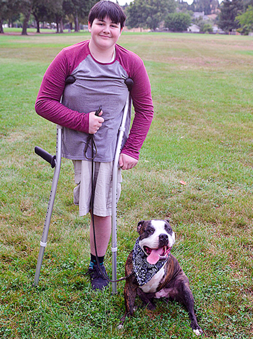 A Young Cancer Survivor & Amputee Finds A BFF In A 3-Legged Rescue Dog